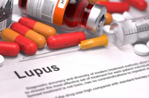 Medicare Value - Lupus
